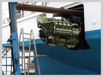Removal of organ