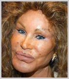 jocelyn-wildenstein-horror.jpg